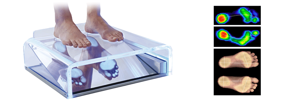 Analisi del passo con podoscopio